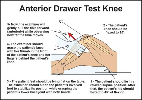 ccl tear drawer test|anterior drawer test interpretation.